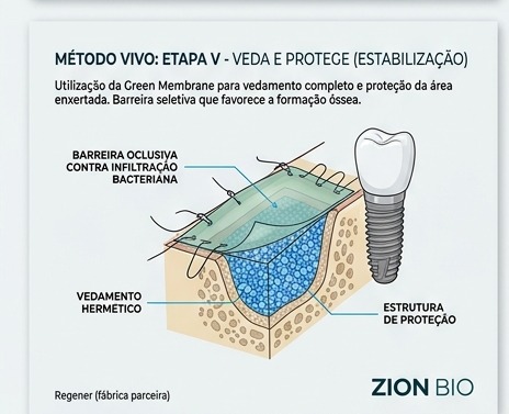 Metodo VIVO - veda e protege com Green Membrane - ZionBio