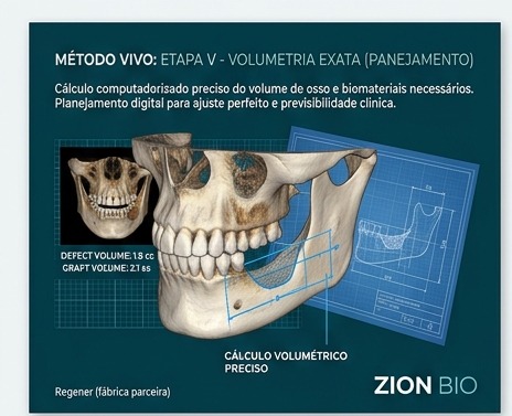 Metodo VIVO - volumetria exata - enxerto osseo odontologico ZionBio