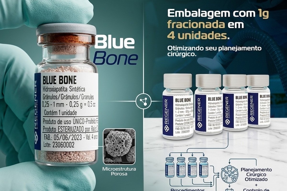 Blue Bone, enxerto ósseo sintético da ZionBio, embalagem com 4 unidades