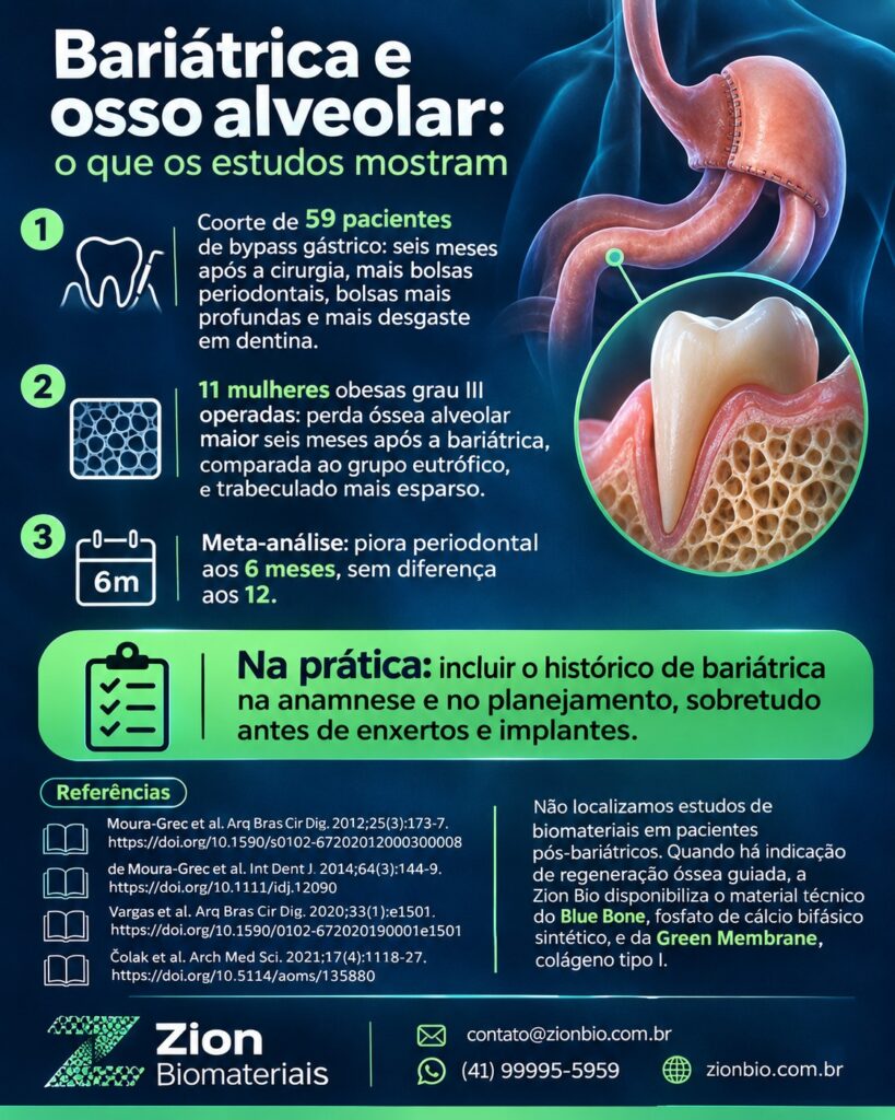 Infográfico: cirurgia bariátrica e osso alveolar, o que os estudos mostram